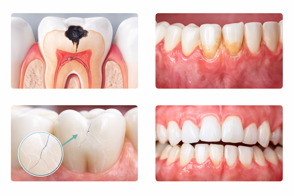 hidden dental issues