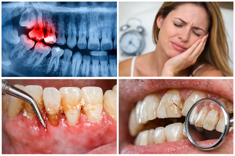 Why Ignoring Your Oral Health Can Be Dangerous