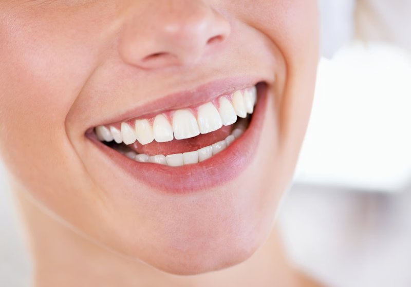 Teeth Whitening