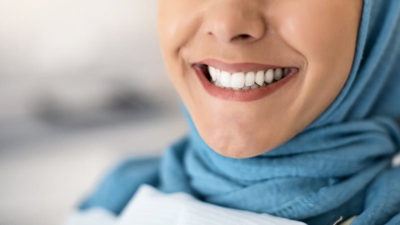 Veneers & Lumineers