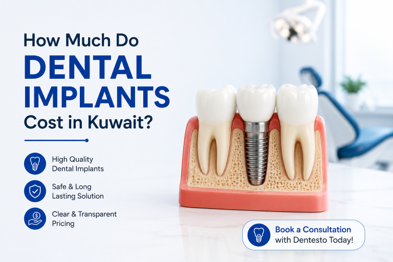 How Much Do Dental Implants Cost in Kuwait? A Complete Guide